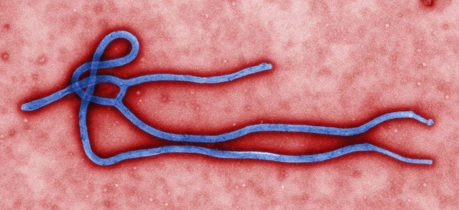 Ebola: What is it? And how can it spread? 